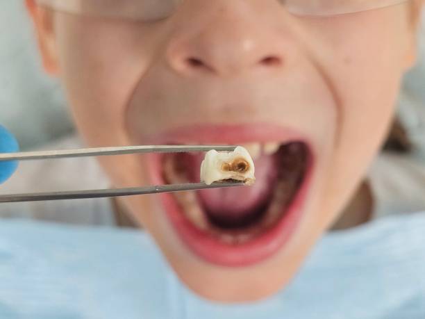 Best Emergency Denture Repair in Croswell, MI
